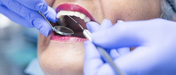 Best Emergency Tooth Extraction  in Calico Rock, AR